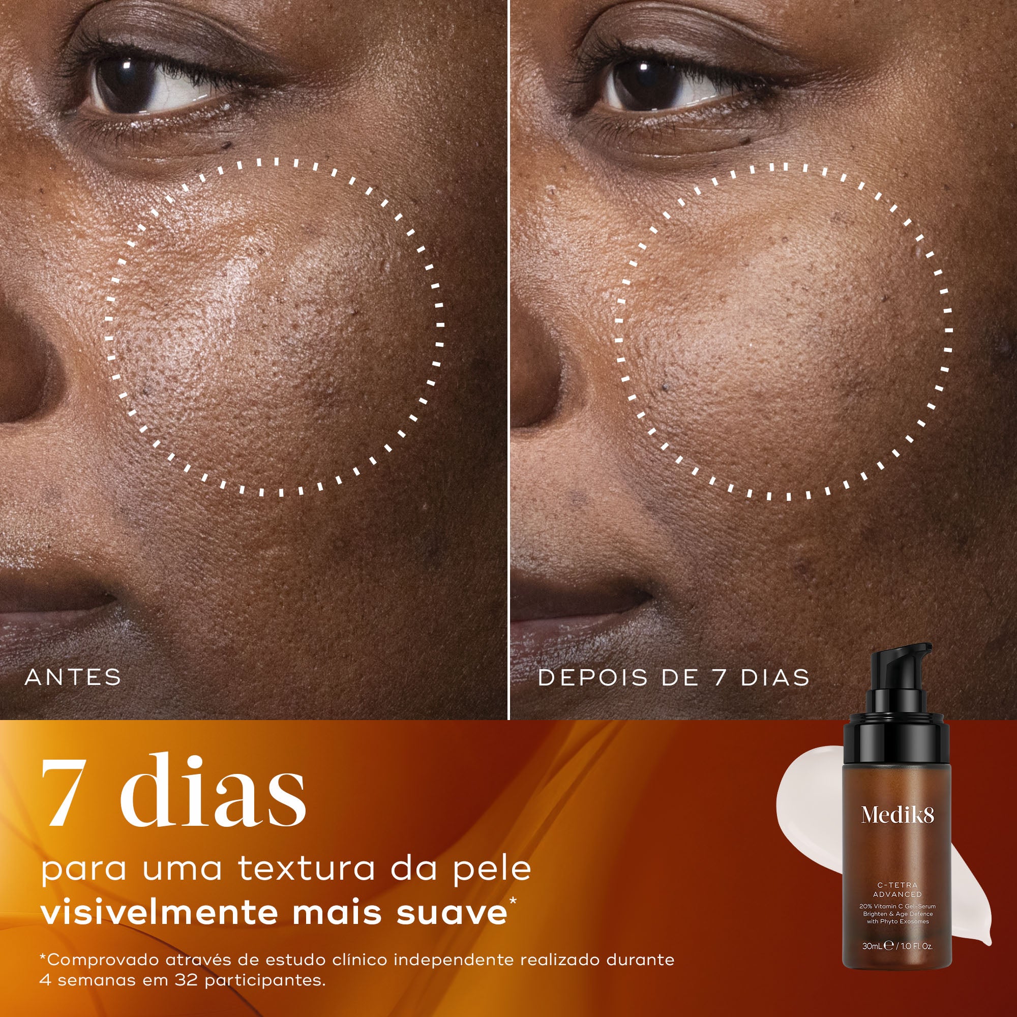 C-Tetra Advanced – Medik8-PT