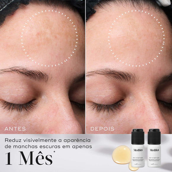 Comparação de antes e depois de uma testa ao longo de 1 mês, com um círculo pontilhado destacando uma redução visível das manchas escuras. Abaixo, os dois frascos de Oxy-R Peptides são mostrados com o texto afirmando que reduz visivelmente a aparência de manchas escuras em apenas 1 mês.-hover-19