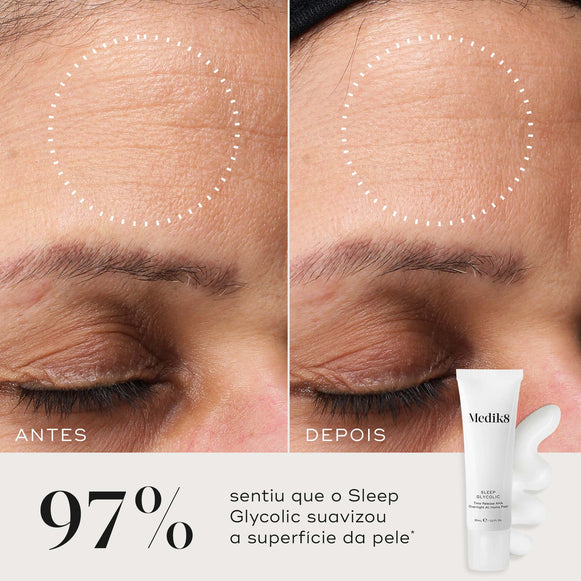 Comparação de antes e depois de uma testa, com um círculo pontilhado destacando uma textura de pele visivelmente mais suave. Abaixo, ao lado de um tubo de Sleep Glycolic e uma amostra de creme, o texto afirma que 97% sentiu que o Sleep Glycolic suavizou a superfície da pele.-hover-2