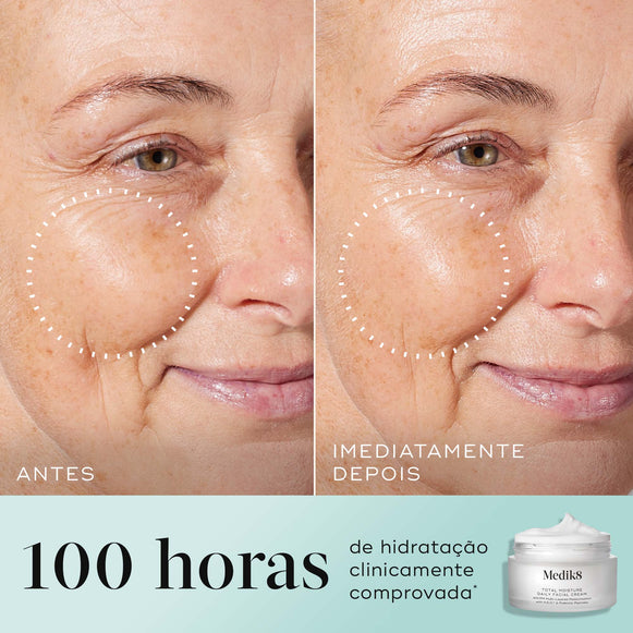 Total Moisture Daily Facial Cream™ 50ml hover