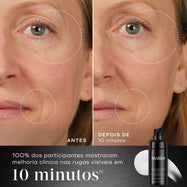 Comparação antes e depois da área da bochecha e dos olhos de uma participante ao longo de 10 minutos, ao lado de um frasco de Medik8 Liquid Peptides Advanced MP. O texto em português destaca que 100% dos participantes mostraram melhoria clínica nas rugas visíveis em 10 minutos.