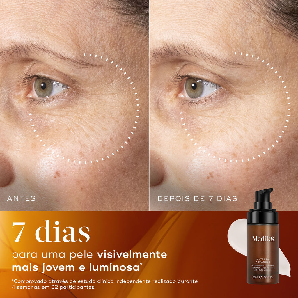 Comparação de antes e depois focada nas linhas finas ao redor do olho de um participante ao longo de 7 dias. Círculos pontilhados destacam a melhoria. Na parte inferior, o frasco do sérum Medik8 C-Tetra Advanced é exibido com o texto afirmando 7 dias para uma pele visivelmente mais jovem e luminosa.