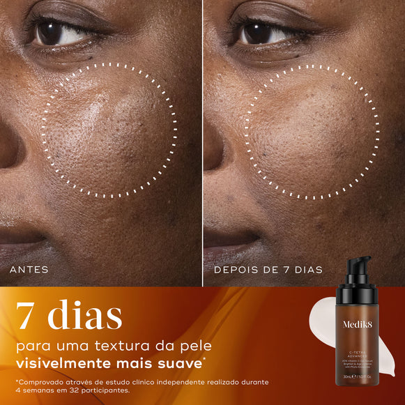 Comparação de antes e depois da pele de tom escuro de um participante ao longo de 7 dias. Círculos pontilhados destacam uma melhora visível na textura da pele. Abaixo, o frasco do sérum Medik8 C-Tetra Advanced é mostrado ao lado de uma amostra de creme com o texto afirmando 7 dias para uma textura de pele visivelmente mais suave.-hover-3