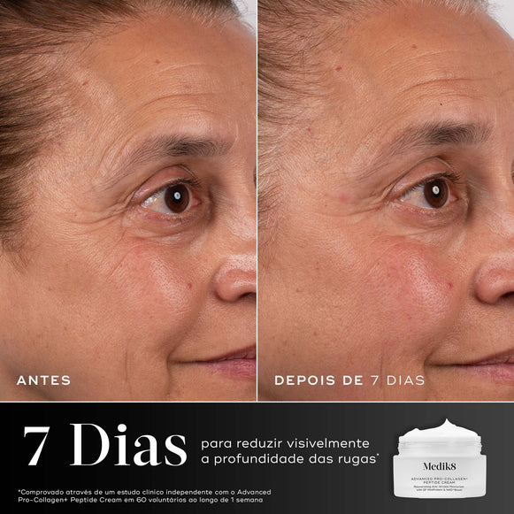 Um close-up de comparação de antes e depois da área dos olhos de uma mulher ao longo de 7 dias é mostrado contra um fundo cinza escuro dividido. Os rótulos "ANTES" e "DEPOIS DE 7 DIAS" estão na parte inferior. Um gráfico abaixo mostra um frasco de creme Medik8 e um texto branco grande informando 7 Dias para reduzir visivelmente a profundidade das rugas. Uma isenção de responsabilidade detalha o estudo clínico independente.-hover-4