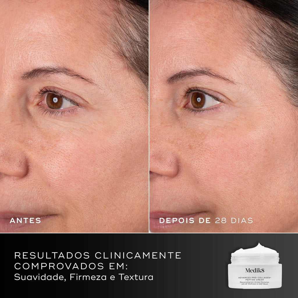 Uma comparação de antes e depois da área dos olhos e da bochecha de uma pessoa ao longo de 28 dias contra um fundo dividido em preto e cinza escuro. Rótulos de texto "ANTES" e "DEPOIS DE 28 DIAS". Um gráfico na parte inferior mostra um frasco de creme Medik8 e um texto informando resultados clinicamente comprovados em suavidade, firmeza e textura.
