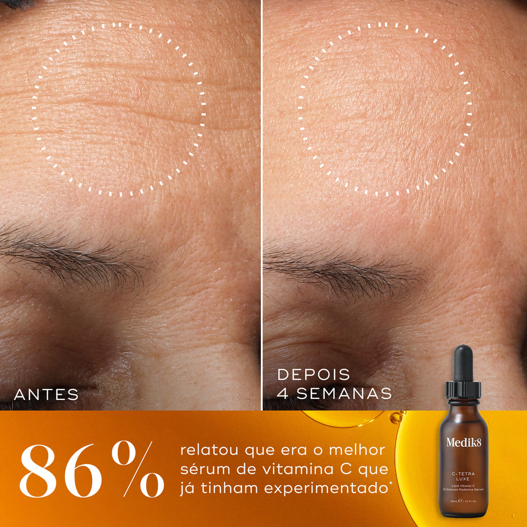 Comparação de antes e depois de rugas na testa ao longo de 4 semanas, com um círculo pontilhado destacando uma pele visivelmente mais suave. Abaixo, ao lado de um frasco de C-Tetra Luxe, o texto afirma que 86% relatou que este era o melhor sérum de vitamina C que já tinham experimentado.