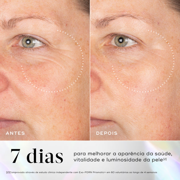 Comparação antes e depois da área dos olhos de uma participante ao longo de 7 dias. O texto em português aponta 7 dias para melhorar a aparência da saúde, vitalidade e luminosidade da pele.-hover-1